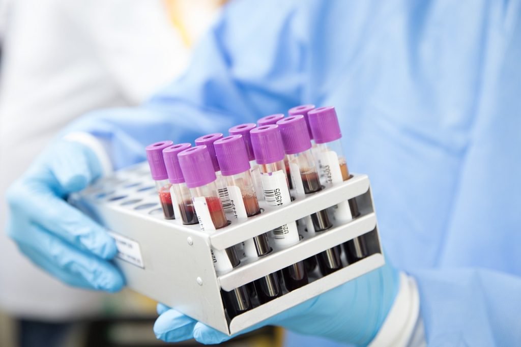 Blood sample tubes drawn to run a dog liver panel