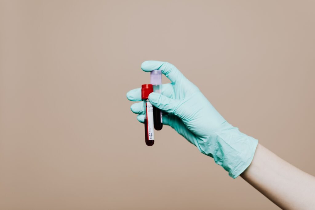 Gloved hand holding a blood sample tube used to measure creatinine in dogs