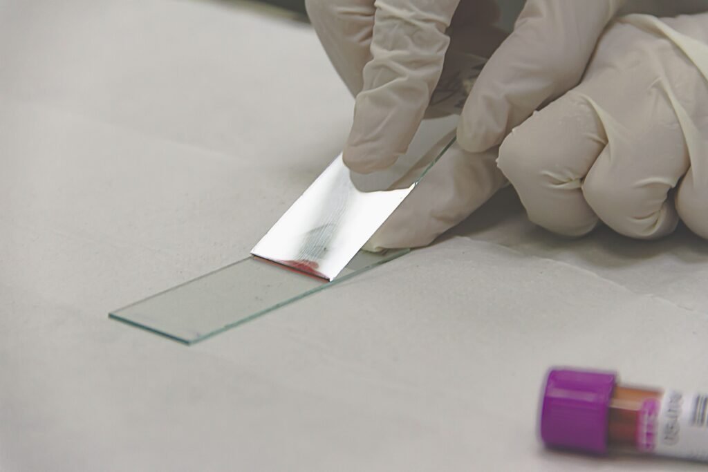 Gloved hands holding microscope slides, as prepared from a fine needle aspirate